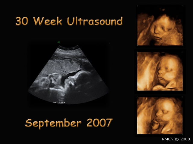 Collage_Ultrasound_02_opt.jpg