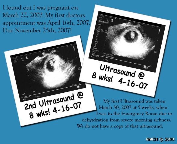 Collage_Ultrasound_01_OPT.jpg