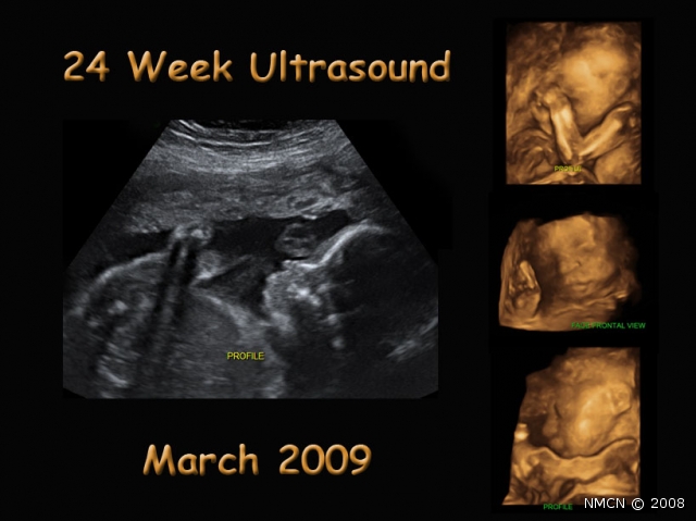 Collage_Ultrasound02_opt.jpg